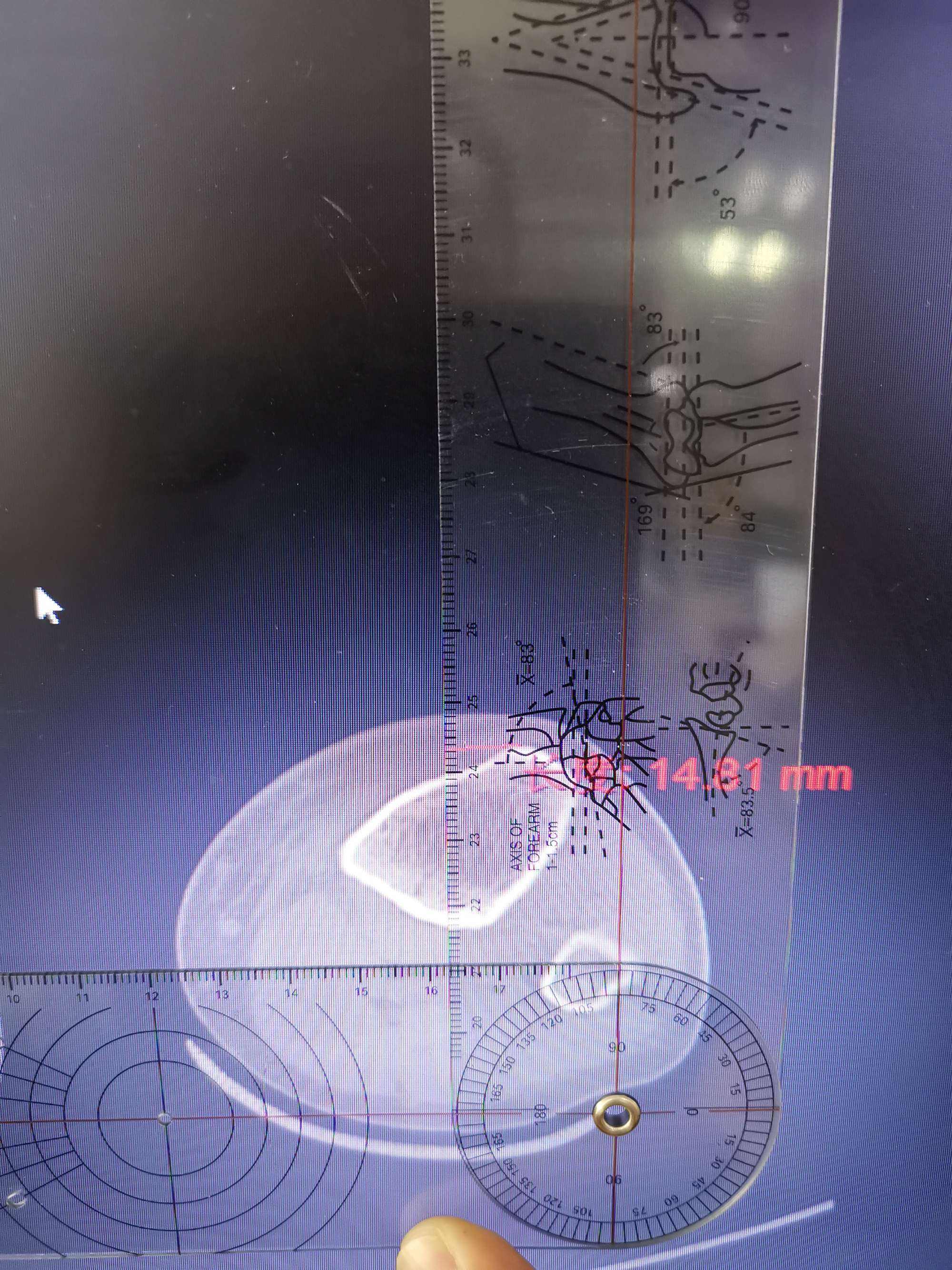 TG医学上是什么意思正常值的简单介绍